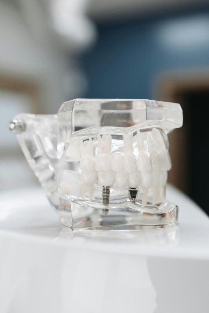 Understanding the Cost of Dental Implants: Breakdown & What to Expect